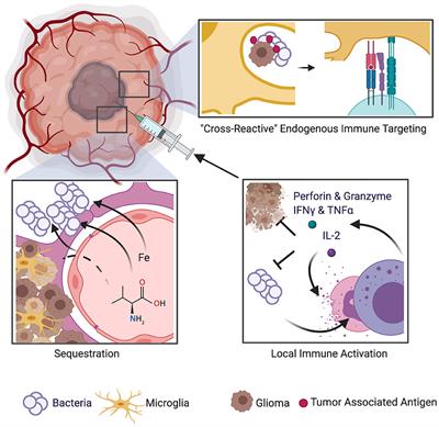 The Survival Benefit of Postoperative Bacterial Infections in Patients With Glioblastoma Multiforme: Myth or Reality?